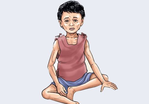 विश्व भोकमरी सूचकांक २०२६ मा नेपाल ७२औँ स्थानमा