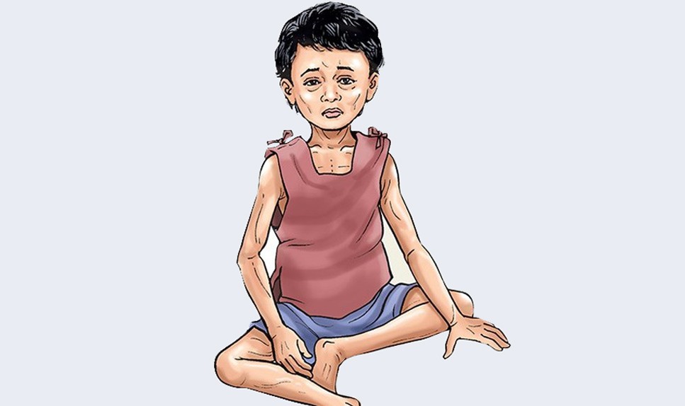 विश्व भोकमरी सूचकांक २०२६ मा नेपाल ७२औँ स्थानमा